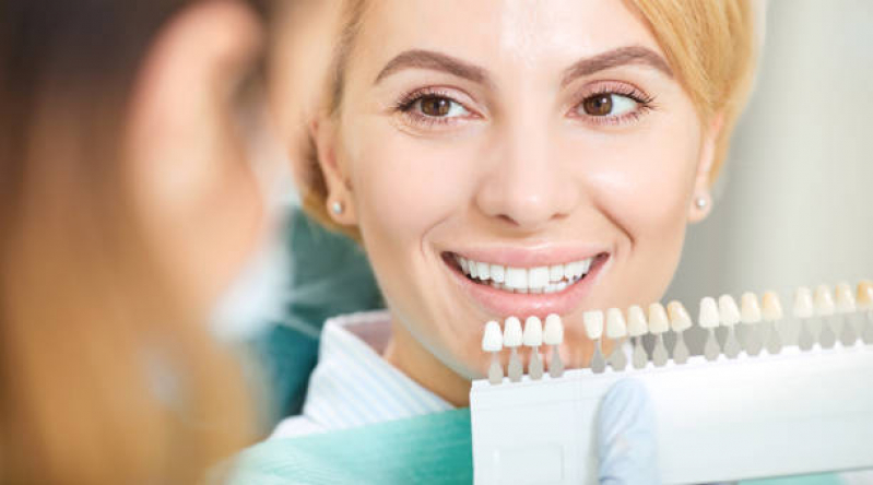Clinica de Implante de Resina Dental Interlagos - Implante Dentário Todos Os Dentes