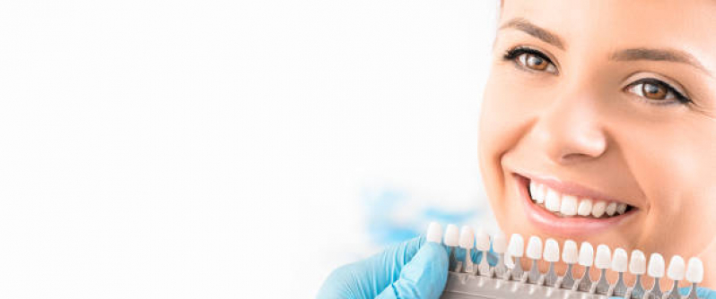 Clinica Que Faz Implante Dentário Todos Os Dentes Saúde - Implante de Resina Dental