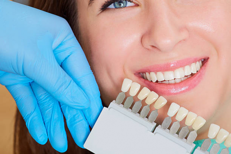 Clinica Que Faz Implante do Dente da Frente Brooklin Novo - Implante de Todos Os Dentes