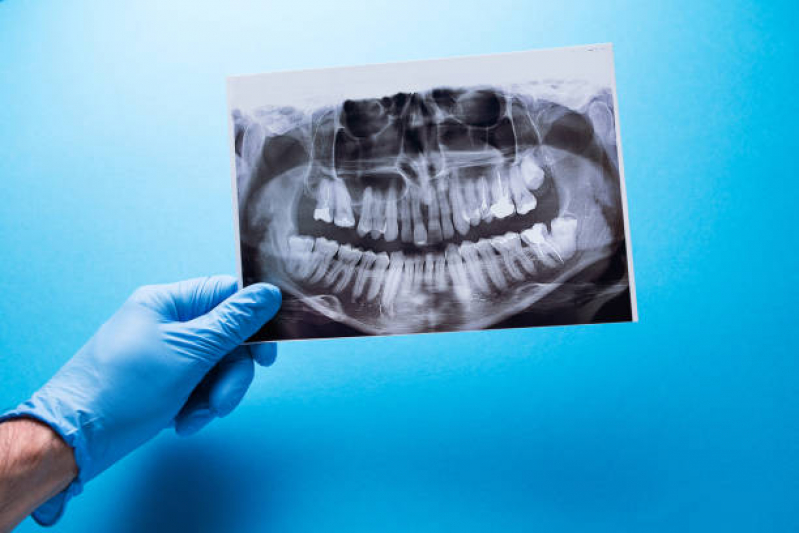 Clinica Que Faz Radiografia Digital Odontologia Vila Olímpia - Raio X Digital Odontologico Cambuci