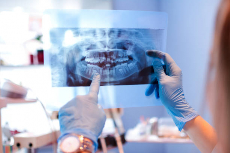 Clinica Que Faz Rx Panoramica Odontologico Rua Haddock Lobo - Raio X Odonto