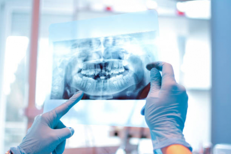 Clinica Que Faz Rx Panoramico Odontologico Vila Dom Pedro I - Radiografia Digital Odontologia