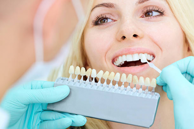 Implante de Resina Dental Próximo/ Perto GAZETA - Implante no Dente da Frente