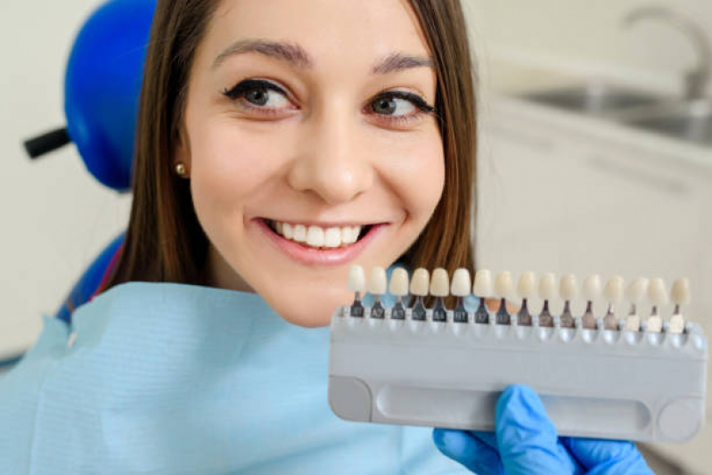 Implante Dente da Frente Santa Cecilia - Implante no Dente da Frente