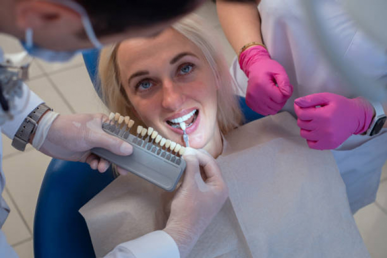 Implante no Dente da Frente Agendar Morro dos Ingleses - Implantes de Dentes