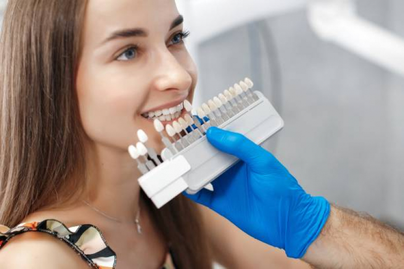 Implante no Dente da Frente Marcar Jardim Belga - Implante no Dente da Frente