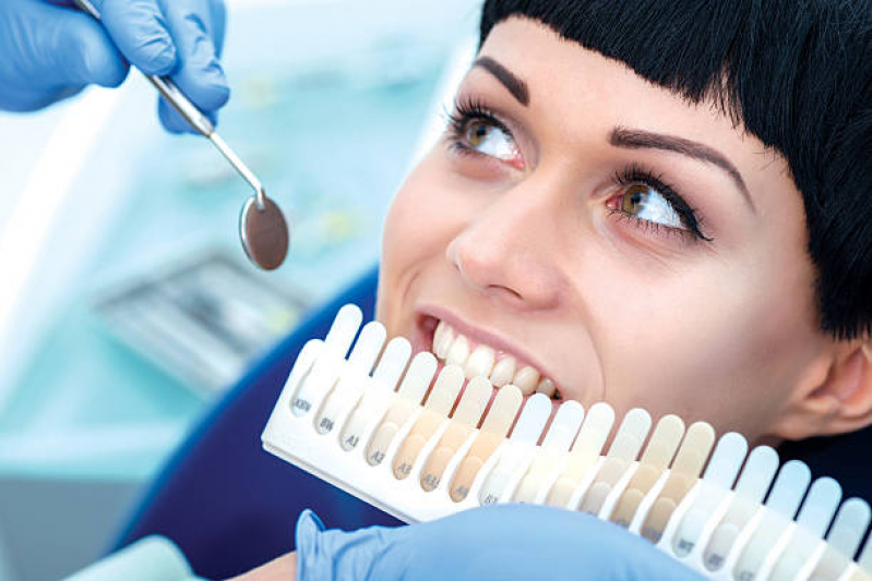 Implante no Dente da Frente Santo Amaro - Implante Dental