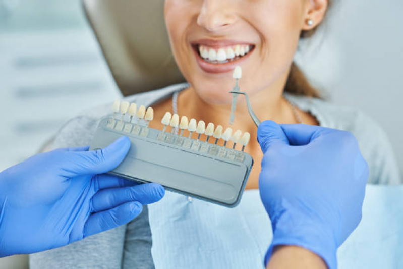 Implantes de Dentes Marcar Centro - Implante no Dente da Frente