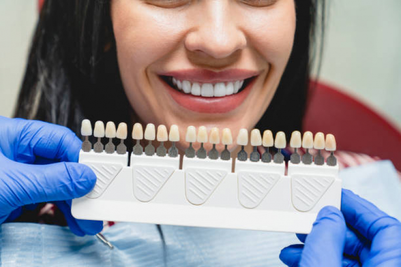 Implantes Dentes Marcar Jardim Caravelas - Implante no Dente da Frente