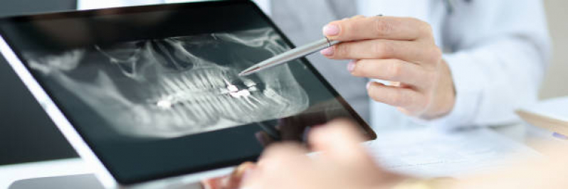 Radiografia Digital Odontologia Marcar Saúde - Rx Panoramico Odontologico