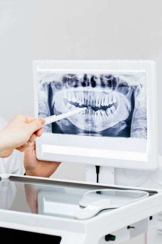 Raio X Panoramico Odontologico Agendar Campo Belo - Rx Digital Odontologico