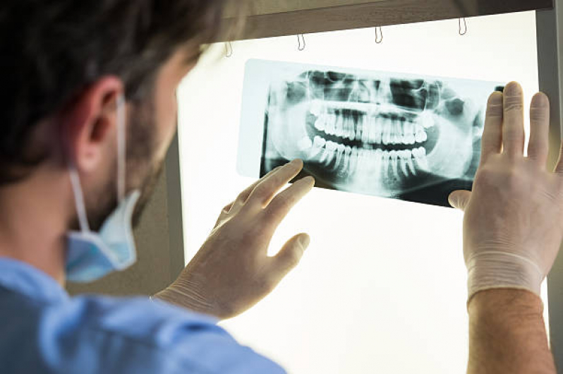 Raiox Odonto Marcar Jardim da Saúde - Radiografia Digital Odontologia