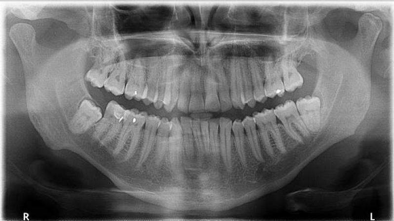Rx Odonto Alto do Ipiranga - Raio X Digital Odontologico Cambuci