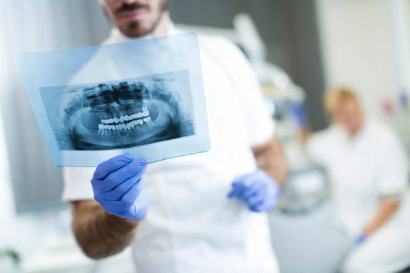 Rx Panoramico Odontologico Cambuci - Radiografia Digital Odontologia