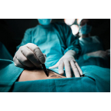 cirurgia de otoplastia Próximo/ perto Conjunto Nacional
