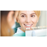 clinica de implante de resina dental Cambuci