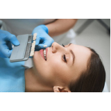 clinica de implante dentário todos os dentes Ibirapuera