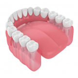 clinica de implante dentario total Mirandópolis