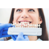 clinica de implante no dente da frente Socorro