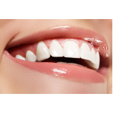 clinica especializada em faceta de porcelana em dente com canal Morumbi