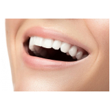 clinica especializada em faceta para os dentes Socorro