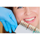 clinica que faz implante do dente da frente Higienópolis