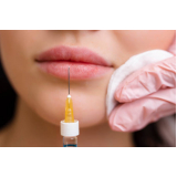 clinica que faz preenchimento labial com ácido hialurônico Morro dos Ingleses