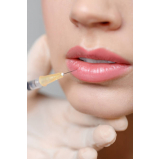 clinica que faz preenchimento labial com agulha Santo Amaro