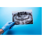 clinica que faz radiografia digital odontologia Chácara Santo Antônio