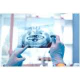 clinica que faz rx panoramico odontologico Glicério