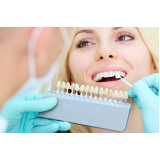 implante de resina dental Jardim Prudência