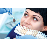 implante do dente da frente Clinicas