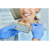 implantes de dentes marcar Bixiga
