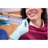 implantes dentes agendar Socorro