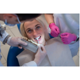 implantes dentes Cambuci
