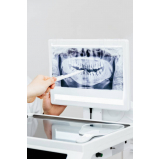 onde fazer radiografia digital odontologia Chácara Flora
