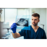 radiografia digital odontologia agendar Sé