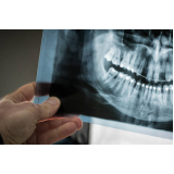 raio x panoramico odontologico Ibirapuera