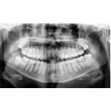 rx odontologico marcar Glicério