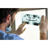 rx odontologico panoramico Saúde